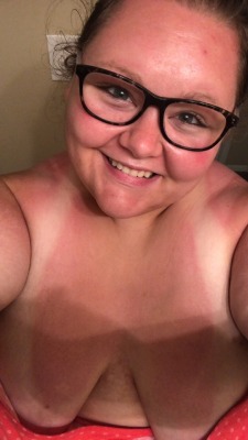 bigxgirlsxlovexsex: I got some serious sun this last weekend…today,