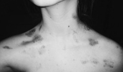 justmysxlf:  hickeys look great 