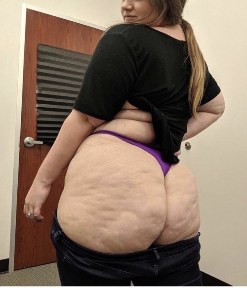 cellulitebooty: