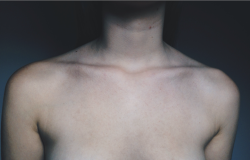 soulescaper:  mm’s collarbones 