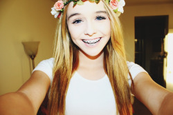 sexpectinq:  tacolol:  Do you ever just  acacia you are perf