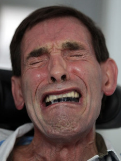 Locked-in syndome sufferer Tony Nicklinson shows emotion as he
