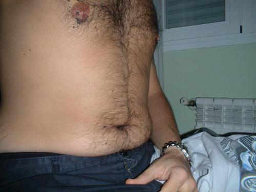 feedmealive:  See what overeating do! Â First picture is an old one and all the others are from actually. Looking for a feeder girl to make me much more fatter.  Me!