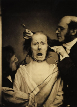 sixpenceee:  UNETHICAL EXPERIMENTS: SHOCKS FOR PICTURES In 1862,