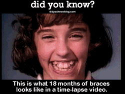 did-you-kno:  Vintage orthodontery at its finest.Source
