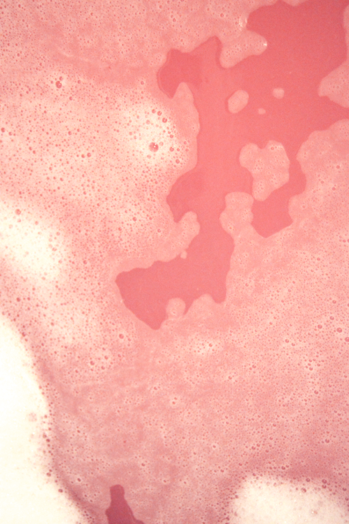 5u5:  5u5:  my first bathbomb !!!  guess who got a urinary tract infection !!  Story of my life…. 
