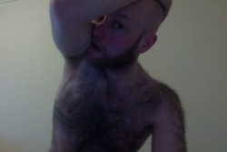 Bald and hairy Men