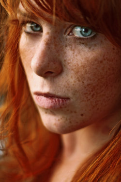 myfairladies:  If you like redheads, freckles and pale ladies