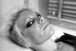 vaticanrust:    Wendy O Williams of The Plasmatics getting acupuncture.