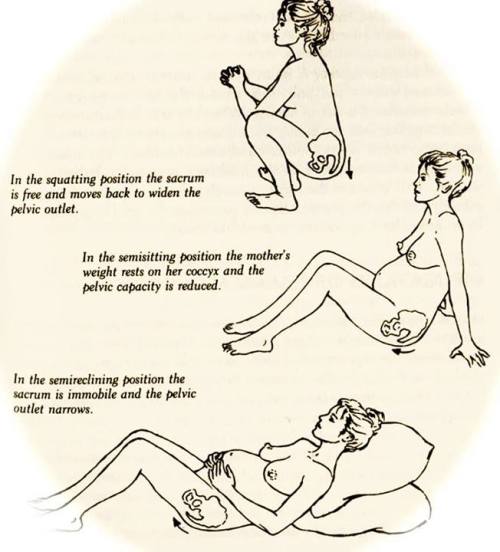 petitedeath:  people always looked at m wild when i said i wanted to squat for birth. other things becides making it easier that it does is reduce risk of tearing, the pressure helps to numb the vagina, it makes contractions less painful (trust me the