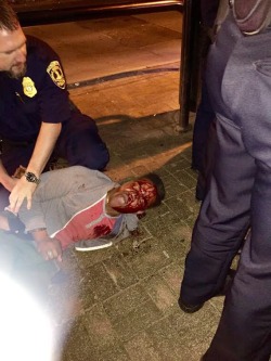 pepperedinpearls:  Even Bossip picked up the story (http://bossip.com/1118641/bossip-exclusive-black-uva-student-brutally-beat-by-cops-for-something-every-college-kid-does/).