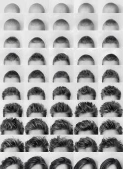 theworrldisugly:  This woman photographed her hair growing back