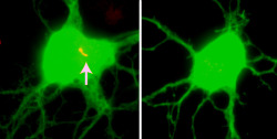 neurosciencestuff:  The white arrow highlights the primary neuronal