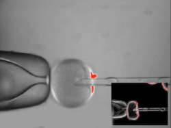 neurosciencestuff:  Human stem cells successfully cloned for