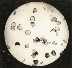 dame-de-pique:  Arno Vater, 1931  Diatomaceous earth Cestoda,