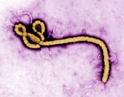 mindblowingscience:  Single-dose, needle-free ebola vaccine provides