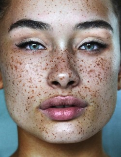  Lovely Freckled faces Part 1. 