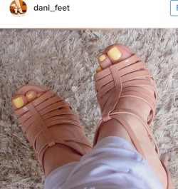 crazysexytoes:  Gorgeous yellow toes
