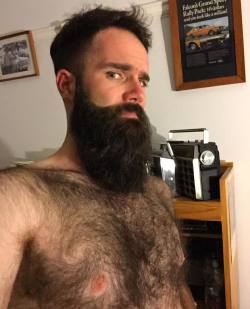 beardlad:  Anyone else have weird swirls in their chest hair?