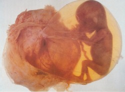 avtavr:  Healthy fetus of a human at 16 weeks maturity, dwelling