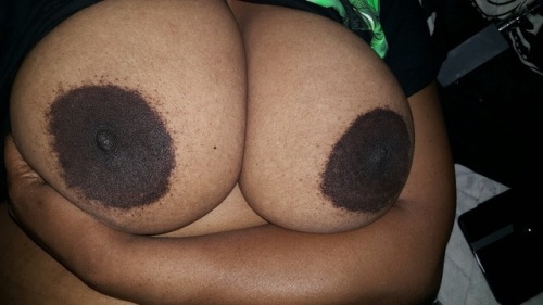 ismaeilko:Dark huge areolas 