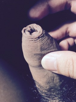 erikforeskin:  bb-or-not-bb:  I’ve stretched my foreskin:)