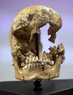 sixpenceee:    Skull of a 14 year-old girl believed to be a victim