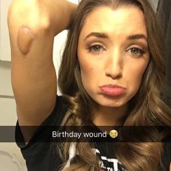 A birthday wouldn’t be complete without a birthday wound.