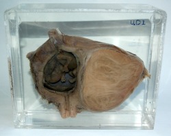 This particular specimen belongs to UCL Pathology Collections,