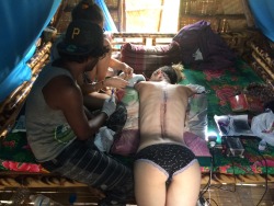 camdamage:  How could I not get a huge spinal tattoo in a hut