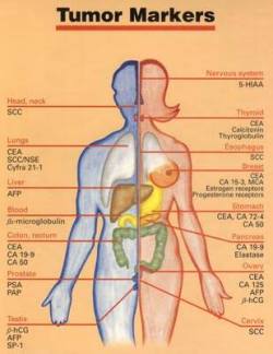 usmlenotes:  Few Important TUMOR MARKERS! 