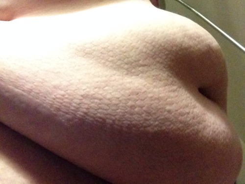 the-need-for-feed:  My belly after 9 hours in fishnets.