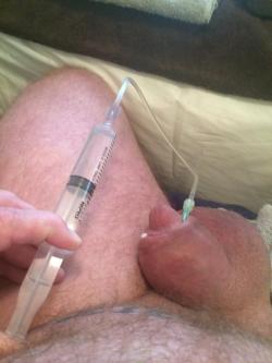 Silicone is injected very easily alone, almost like water with syringe and needle. You can do it alone. Everything is supplied with the silicone, syringes, tubing, needles, and other &hellip;each vial contains 100cc.  You can do it !!  https://lebulge.tum