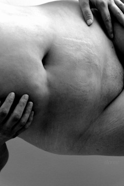 tlcrmtphotography:  Tummy series IV Stretch marks and scars B/W