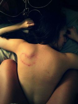 camuutorino:  Hickies