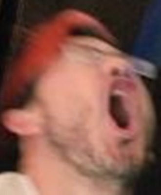 When you accidentally stub your toe