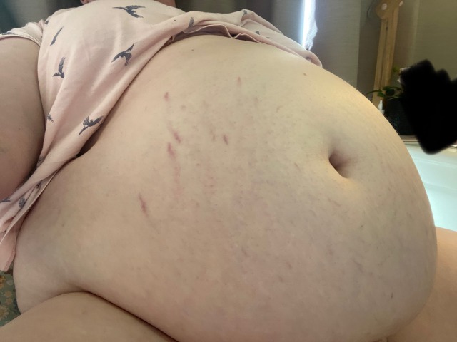 thicquex:Guess who’s getting brand new stretch marks
