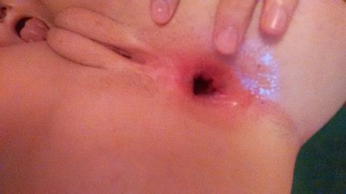 used-trash:  And the result…3 free holes in a row 