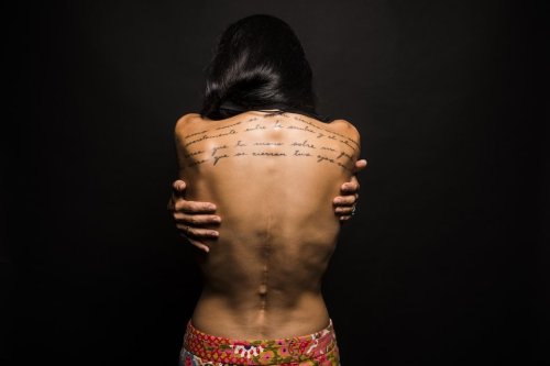 huffingtonpost:  24 Women Bare Their Scars To Reveal The Beauty In Imperfections“It’s a reminder that we can heal no matter what happens to us.”Photos by: Damon Dahlen 