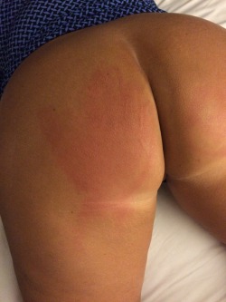 bigdaddysgirl71:  yep999:  @bigdaddysgirl71’s ass after I slapped