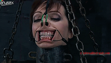 mouthlock:This happens if you have a really dominant dentist. ;) MM  Bondage and fetish images @  Art of Bondage