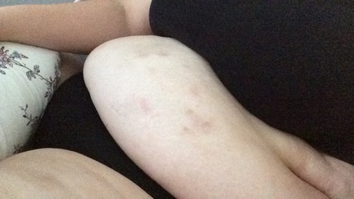 sleazy-deezy:  babe gave me quite a few belly bruises 