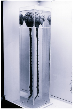 sixpenceee:  Brain and Spinal Cord(Source)