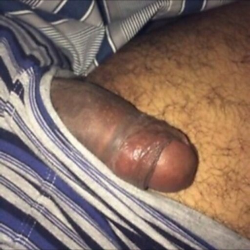 hugewhitedick4you:  Here We Have A White Boy With A Huge Fat Uncircumcised White Boy Cock!!!