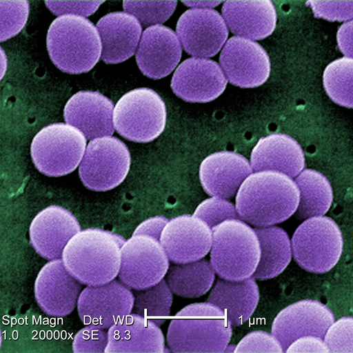 fyeahmicrobiology:  A very pretty visualization of how an influenza