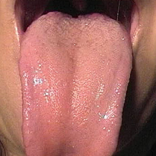 longtongues:  Long pierced tongues are sexyClick here to meet