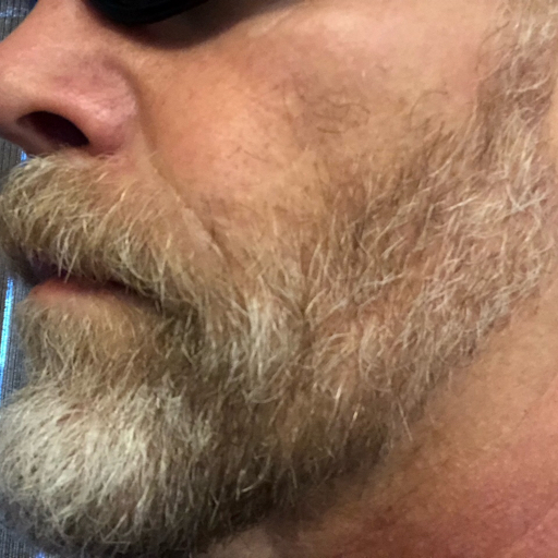yesyouhavetoaskthings:  The old lip bite… grrrr