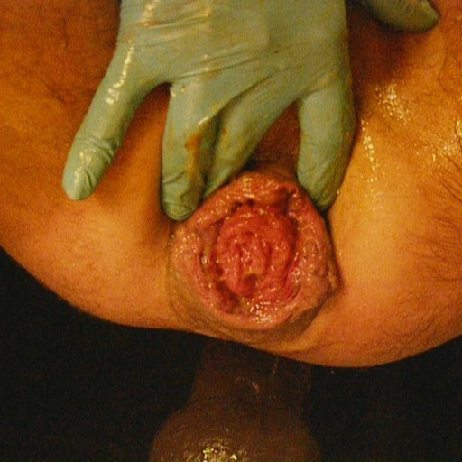 drtylamsclguy:  Love a top into working a hole until it gapes