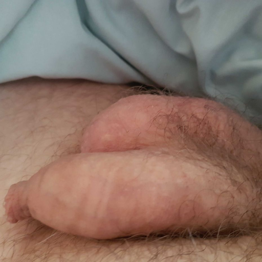 deliciously-uncut:  crazykennyblog:  carefully draws back the skin to show the head which just needs a stroking so bad.   A beautiful soft uncut cock 