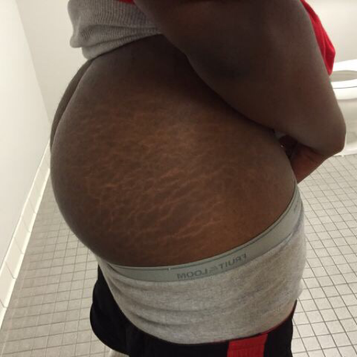 babyplies87:  endo69:  Wow  I love bottoms like this….. thats